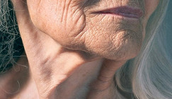 Οι γιατροί ανακάλυψαν τι είδους τροφή επιταχύνει τη γήρανση